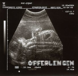 OFFER echoscopie DEF